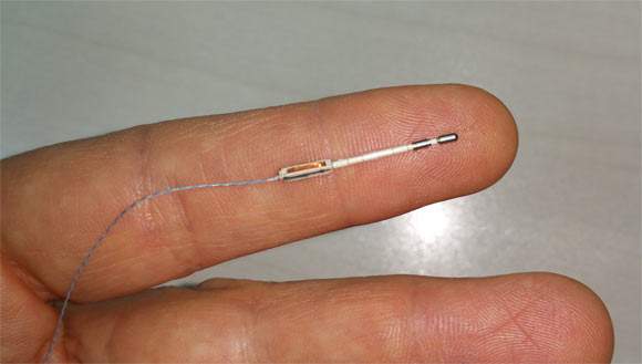 Active nerve cell cluster stimulation is safe for patients with acute ischemic stroke 8-24 h after onset, who are ineligible for thrombolytic therapy. The treatment uses a small neurostimulator electrode that is temporarily implanted through the roof of the mouth. Image credit: BrainsGate.