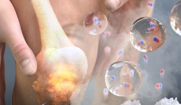 NO-Scv gel-mediated anti-inflammation therapy. Image credit: Pohang University of Science and Technology.