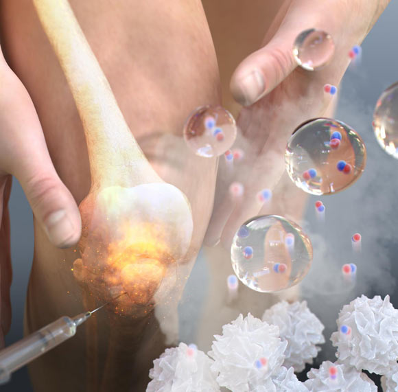 NO-Scv gel-mediated anti-inflammation therapy. Image credit: Pohang University of Science and Technology.