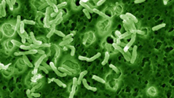Mycobacterium vaccae. Image credit: Christopher Lowry, University of Colorado, Boulder.
