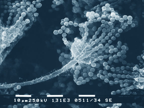 This scanning electron microscopic (SEM) image depicts a close up of Aspergillus sp. fungal fruiting body. This reproductive structure is composed of a septate filament known as a conidiophore, which is topped by chains of conidiospores. Image credit: Janice Haney Carr & Robert Simmons, CDC.