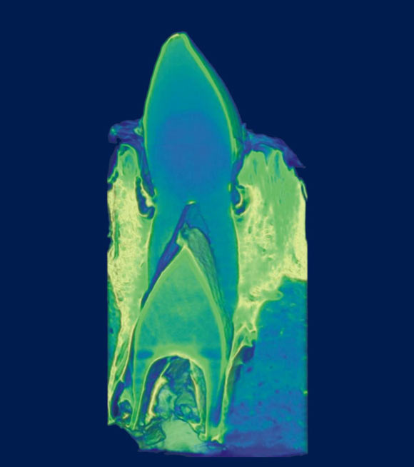 CT scan of a crocodile tooth. Image credit: University of Missouri.
