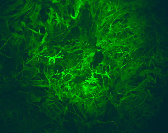 Astrocytes tagged with green fluorescent antibody. Image credit: Instituto de Medicina Molecular João Lobo Antunes / António Pinto-Duarte.