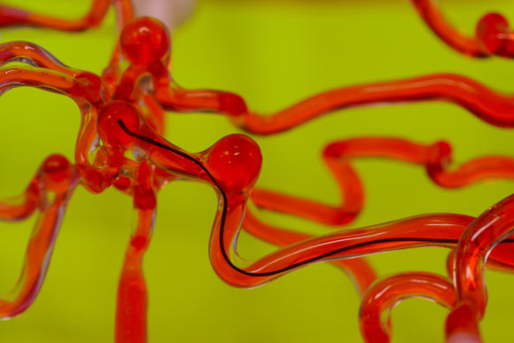 Kim et al developed robotic thread that can be steered magnetically and is small enough to work through narrow spaces such as the vasculature of the human brain; the researchers envision the technology may be used in the future to clear blockages in patients with stroke and aneurysms. Image credit: MIT.
