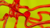 Kim et al developed robotic thread that can be steered magnetically and is small enough to work through narrow spaces such as the vasculature of the human brain; the researchers envision the technology may be used in the future to clear blockages in patients with stroke and aneurysms. Image credit: MIT.