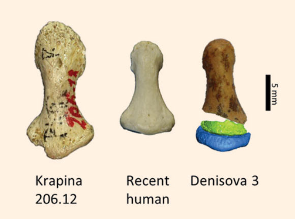 Comparison of the fifth finger phalanx of a Neanderthal (Krapina 206.12), a recent modern human, and the reconstructed Denisova 3. Image credit: Bennett et al, doi: 10.1126/sciadv.aaw3950.