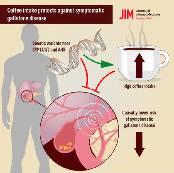 Coffee consumption is associated with low risk of symptomatic gallstone disease. Image credit: Nordestgaard et al, doi: 10.1111/joim.12970.