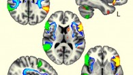 The language brain regions were more coordinated in left-handers between the two sides of the brain (in green and orange) and were also connected by the white matter tracts influenced by one genetic region related to handedness (in blue). Image credit: Gwenaëlle Douaud, University of Oxford.