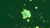 Using a fluorescein isothiocyanate (FITC) conjugated immunoglobulin staining technique, and under direct immunofluorescence (DIF), this tissue sample extracted from a vesicle and ulcer, reveals the presence of herpes simplex antigen in a patient determined to have HSV-2 infection. Image credit: Craig Lyerla / CDC.