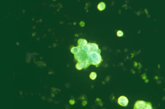 Using a fluorescein isothiocyanate (FITC) conjugated immunoglobulin staining technique, and under direct immunofluorescence (DIF), this tissue sample extracted from a vesicle and ulcer, reveals the presence of herpes simplex antigen in a patient determined to have HSV-2 infection. Image credit: Craig Lyerla / CDC.