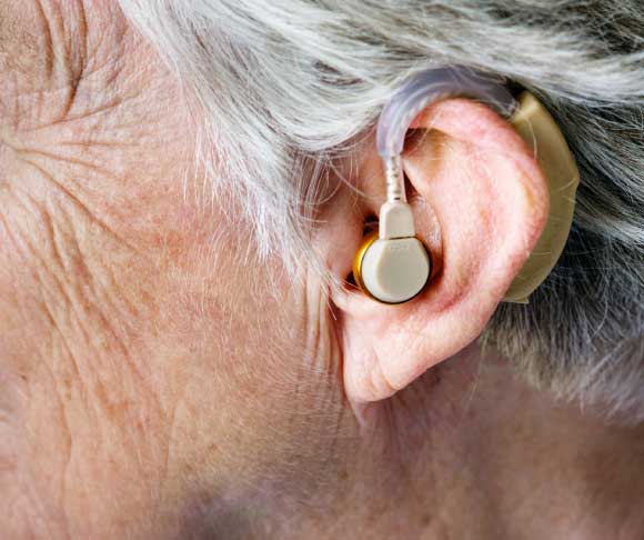 Trpchevska et al. identified 48 associated loci, including 10 novel associations and 8 missense SNPs; the work highlights the role of the cochlear lateral wall including the stria vascularis and the outer sulcus as a contributor to hearing loss; the results provide a valuable resource for the selection of promising genes for further functional validation in pre-clinical models and define targets for screening purposes, drug development, gene therapy, or stratification approaches. Image credit: Pexels.