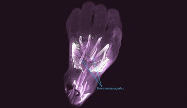 Dorsal view of the left hand of a 10-week old human embryo. The dorsometacarpales are highlighted: these muscles are present in adults of many other limbed animals, while in humans they normally disappear or become fused with other muscles before birth. Image credit: Diogo et al, doi: 10.1242/dev.180349.