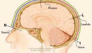 In human skulls, division of the nasioiniac arc (from nasion to inion, NI) by bregma into a shorter frontal arc (from nasion to bregma, NB) and longer parietooccipital arc (from bregma to inion BI), creates a geometrical relationship in which the ratio of the nasioiniac arc over the bregma-inion arc (NI/BI) coincides with the ratio of the bregma-inion arc over the nasion-bregma arc (BI/NB), both 1.6. The subdivision of the nasioiniac arc by bregma into two unequal arcs emulates the geometrical division of a line into the Golden ratio. Image credit: Tamargo & Pindrik, doi: 10.1097/SCS.0000000000005610.