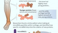Hsueh et al studied cartilage from the hip, knee and ankle and discovered a pattern of regeneration when looking at proteins within the cartilage. Image credit: Alisa Weigandt, Duke Health.