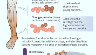 Hsueh et al studied cartilage from the hip, knee and ankle and discovered a pattern of regeneration when looking at proteins within the cartilage. Image credit: Alisa Weigandt, Duke Health.