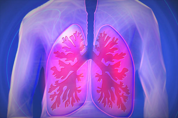 Elliot et al show that fatty tissue is present within the airway wall and is related to BMI, wall thickness and the number of inflammatory cells. The accumulation of airway fatty tissue in overweight individuals may therefore contribute to airway pathophysiology. Image credit: Kalhh.