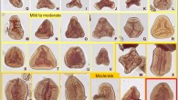 Normal and mutated fern spores from the end-Triassic mass extinction. Scale bar - 20 μm. Image credit: Sofie Lindström, Geological Survey of Denmark and Greenland.