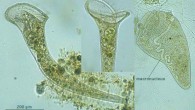 Stentor roeseli is colorless, trumpet shaped, and visible to the naked eye. Image credit: Protist Image Database.