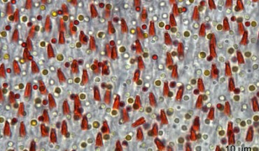 This light microscopy image of the Acadian flycatcher (Empidonax virescens) retina shows the five traditional oil droplet types and the additional orange, conical structures belonging to the newly described photoreceptor. Image credit: Tyrrell et al, doi: 10.1038/s41598-019-51774-w.