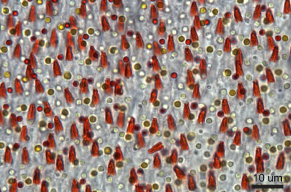 This light microscopy image of the Acadian flycatcher (Empidonax virescens) retina shows the five traditional oil droplet types and the additional orange, conical structures belonging to the newly described photoreceptor. Image credit: Tyrrell et al, doi: 10.1038/s41598-019-51774-w.