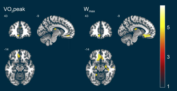 Results of the voxel-based morphometry (VBM) analyses of peak oxygen uptake (VO2peak) and maximal power output (Wmax). The VBM analyses revealed significant positive associations of VO2peak and Wmax with gray matter. Significant clusters with a cluster size of at least 30 voxels are pictured. Image credit: Wittfeld et al, doi: 10.1016/j.mayocp.2019.05.030.