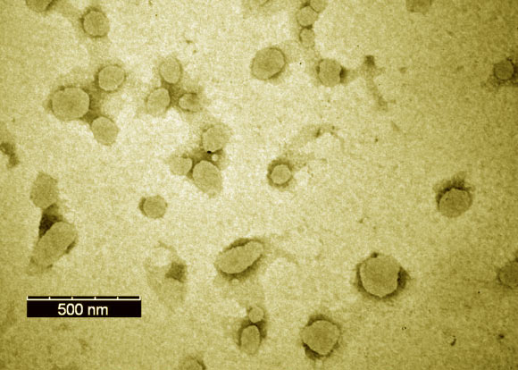TEM image of double-layered M2e-NA nanoparticles. Scale bar - 500 nm. Image credit: Wang et al, doi: 10.1002/adhm.201901176.
