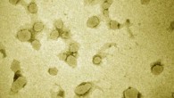 TEM image of double-layered M2e-NA nanoparticles. Scale bar - 500 nm. Image credit: Wang et al, doi: 10.1002/adhm.201901176.