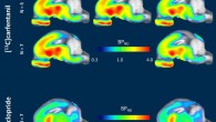 Winterdahl et al investigated the effects of sucrose using positron-emission tomography (PET) imaging with [11C]carfentanil (μ-opioid receptor agonist) and [11C]raclopride (dopamine D2/3 receptor antagonist) in seven female anesthetized Göttingen minipigs. Image credit: Winterdahl et al, doi: 10.1038/s41598-019-53430-9.