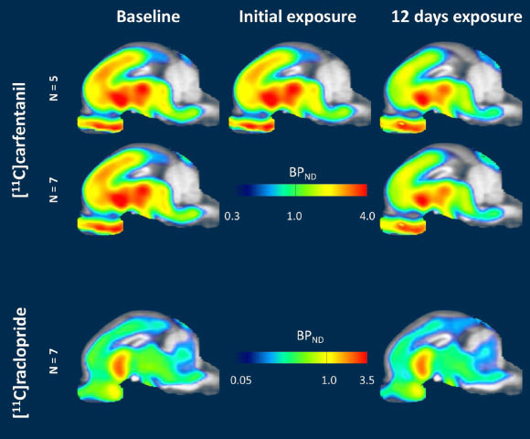 Winterdahl et al investigated the effects of sucrose using positron-emission tomography (PET) imaging with [11C]carfentanil (μ-opioid receptor agonist) and [11C]raclopride (dopamine D2/3 receptor antagonist) in seven female anesthetized Göttingen minipigs. Image credit: Winterdahl et al, doi: 10.1038/s41598-019-53430-9.