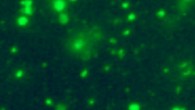 Fluorescence microscopy image of cell-free mitochondria in the plasma of a healthy individual. Image credit: Dache et al, doi: 10.1096/fj.201901917RR.