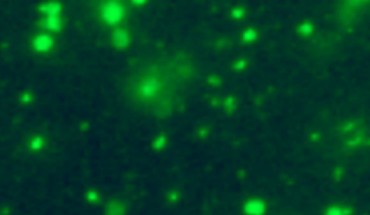 Fluorescence microscopy image of cell-free mitochondria in the plasma of a healthy individual. Image credit: Dache et al, doi: 10.1096/fj.201901917RR.