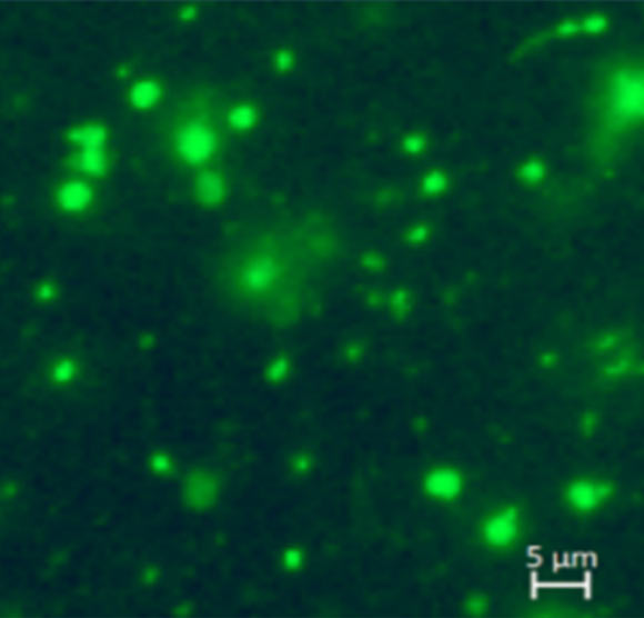 Fluorescence microscopy image of cell-free mitochondria in the plasma of a healthy individual. Image credit: Dache et al, doi: 10.1096/fj.201901917RR.