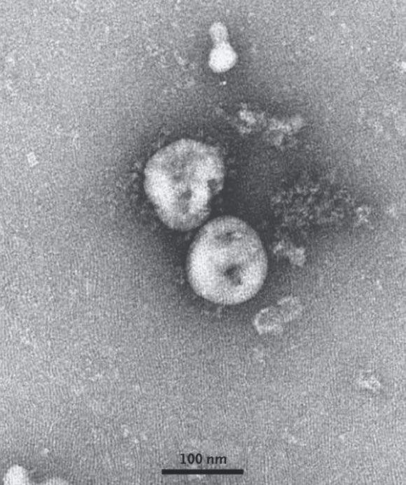 TEM image of 2019-nCoV particles. Image credit: Zhu et al, doi: 10.1056/NEJMoa2001017.
