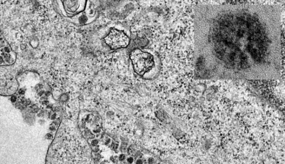 2019-nCoV coronavirus. Image credit: University of Hong Kong.