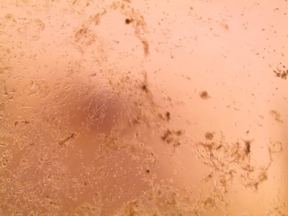A cell layer with a visible cytopathic effect; the cells infected by the 2019-nCoV coronavirus were destroyed. Image credit: National Reference Center for Respiratory Viruses, Institut Pasteur.
