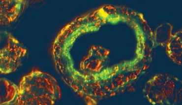 Epifluorescence imagery of a tiny grain within methane hydrate showing internal presence of microbial DNA. Image credit: Snyder et al, doi: 10.1038/s41598-020-58723-y.