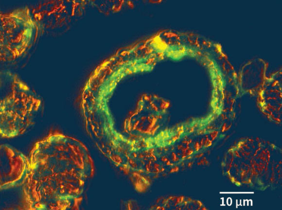 Epifluorescence imagery of a tiny grain within methane hydrate showing internal presence of microbial DNA. Image credit: Snyder et al, doi: 10.1038/s41598-020-58723-y.