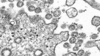 Transmission electron microscopic image of an isolate from the first U.S. case of 2019-nCoV. The spherical extracellular viral particles contain cross-sections through the viral genome, seen as black dots. Image credit: C.S. Goldsmith & A. Tamin / CDC.