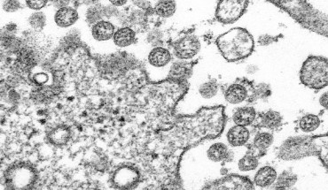 Transmission electron microscopic image of an isolate from the first U.S. case of 2019-nCoV. The spherical extracellular viral particles contain cross-sections through the viral genome, seen as black dots. Image credit: C.S. Goldsmith & A. Tamin / CDC.