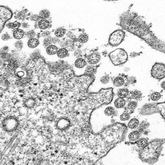Transmission electron microscopic image of an isolate from the first U.S. case of 2019-nCoV. The spherical extracellular viral particles contain cross-sections through the viral genome, seen as black dots. Image credit: C.S. Goldsmith & A. Tamin / CDC.