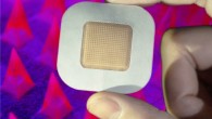 The smart insulin patch. Image credit: Zhen Gu Lab, University of California, Los Angeles.