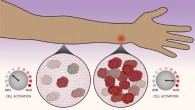 Immune cells count their neighbors before deciding whether or not the immune system should kick into high gear. Image credit: Northwestern University.