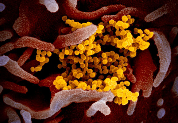 This scanning electron microscope image shows COVID-19 virus (yellow), also known as 2019-nCoV and SARS-CoV-2, isolated from a patient in the U.S., emerging from the surface of cells (pink) cultured in the lab. Image credit: NIAID-RML / CC BY 2.0.