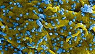 de Wit et al show that remdesivir is a promising antiviral treatment against MERS that could be considered for implementation in clinical trials. This colorized scanning electron micrograph shows MERS virus particles (blue) both budding and attached to the surface of infected VERO E6 cells (yellow). Image credit: NIAID.