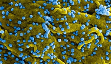 de Wit et al show that remdesivir is a promising antiviral treatment against MERS that could be considered for implementation in clinical trials. This colorized scanning electron micrograph shows MERS virus particles (blue) both budding and attached to the surface of infected VERO E6 cells (yellow). Image credit: NIAID.
