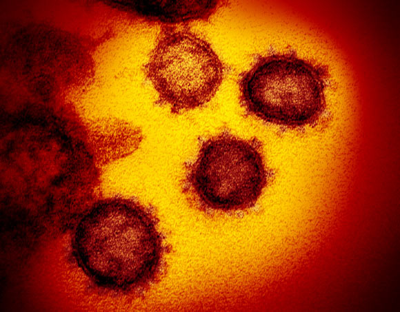 This transmission electron microscope image shows SARS-CoV-2, also known as 2019-nCoV, the virus that causes COVID-19, isolated from a patient in the U.S., emerging from the surface of cells cultured in the lab. Image credit: NIAID-RML.