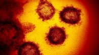 This transmission electron microscope image shows SARS-CoV-2, also known as 2019-nCoV, the virus that causes COVID-19, isolated from a patient in the U.S., emerging from the surface of cells cultured in the lab. Image credit: NIAID-RML.