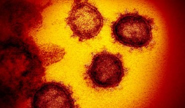 This transmission electron microscope image shows SARS-CoV-2, also known as 2019-nCoV, the virus that causes COVID-19, isolated from a patient in the U.S., emerging from the surface of cells cultured in the lab. Image credit: NIAID-RML.