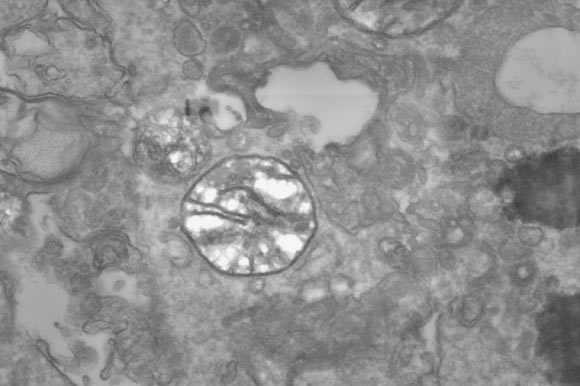 TEM image of Henneguya salminicola mitochondrion-related organelle (center) with few cristae. Image credit: Yahalomi et al, doi: 10.1073/pnas.1909907117.