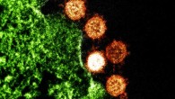 Colorized transmission electron micrograph of SARS-CoV particles (orange) found near the periphery of an infected cell (green). Image credit: NIAID Integrated Research Facility.
